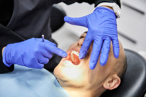 Best Emergency Broken Tooth Repair in Sauk Rapids, MN